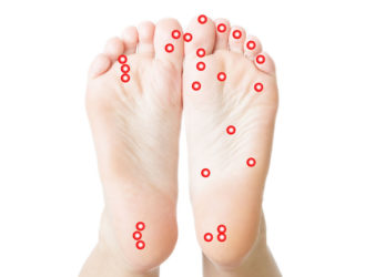 Medical-pedicure-for-diabetics-without-knives
